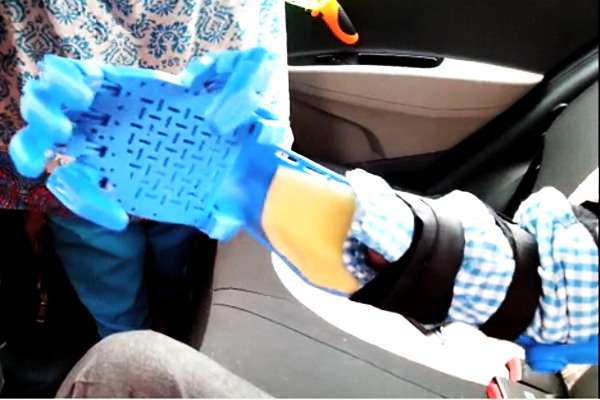 Parshuram Takalkar tries a prototype 3D printed prosthetic hand - Pune - August 5, 2016