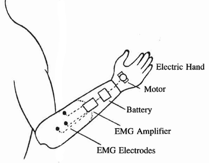 Myoelectric Hand Components